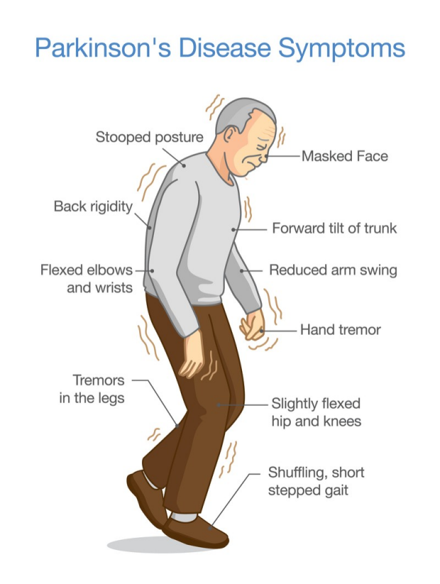 Na imagem, podemos ver uma pessoa idosa com uma postura pouco erecta, relevando problemas na marcha